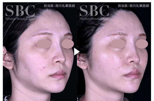 3本セットでよりお得🉐