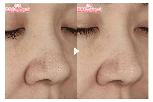 ブラックピール