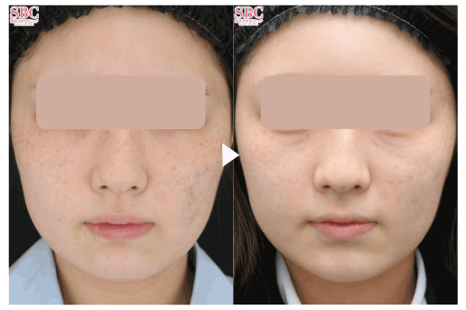 フォトトリプル