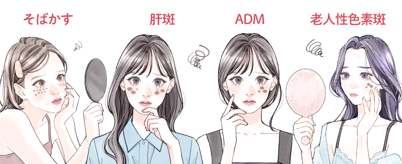 シミ？肝斑？そばかす？ADM？