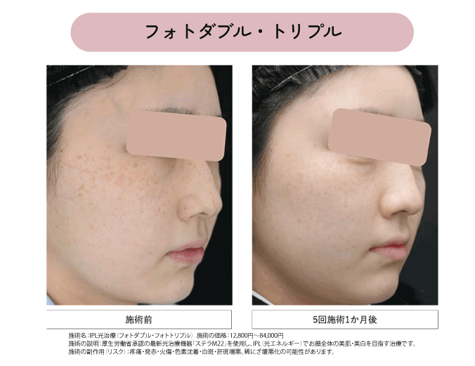 おすすめの治療