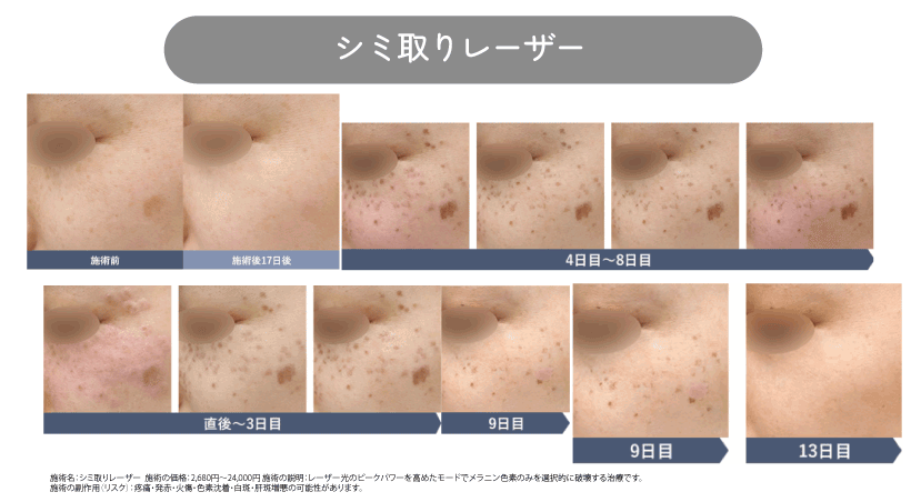 宇都宮で出来るADM治療