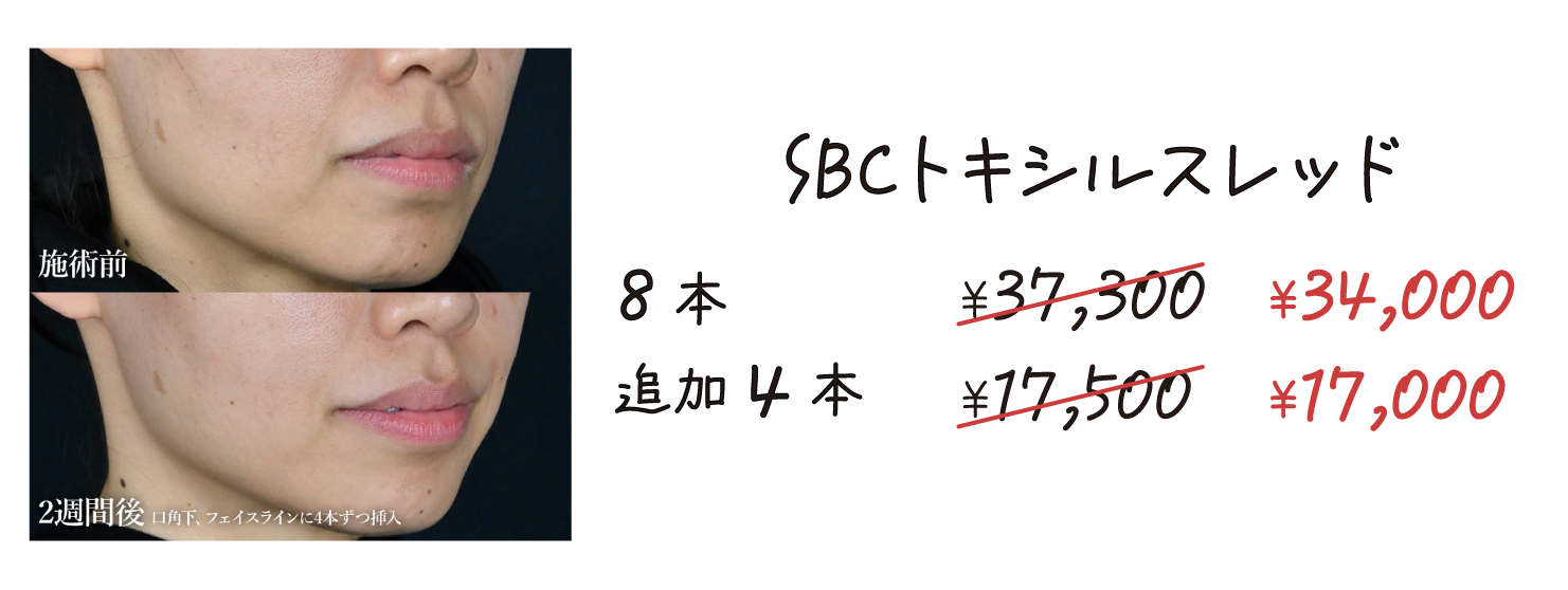 トキシルスレット