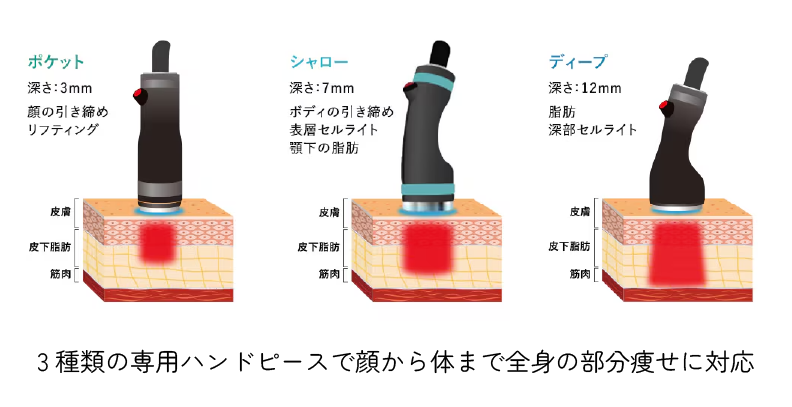 顔から体まで全身の部分痩せに対応