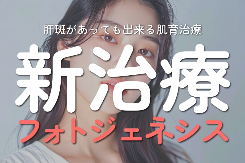 【新治療】宇都宮で肝斑があってもできる肌育レーザー治療｜湘南美容クリニック宇都宮院