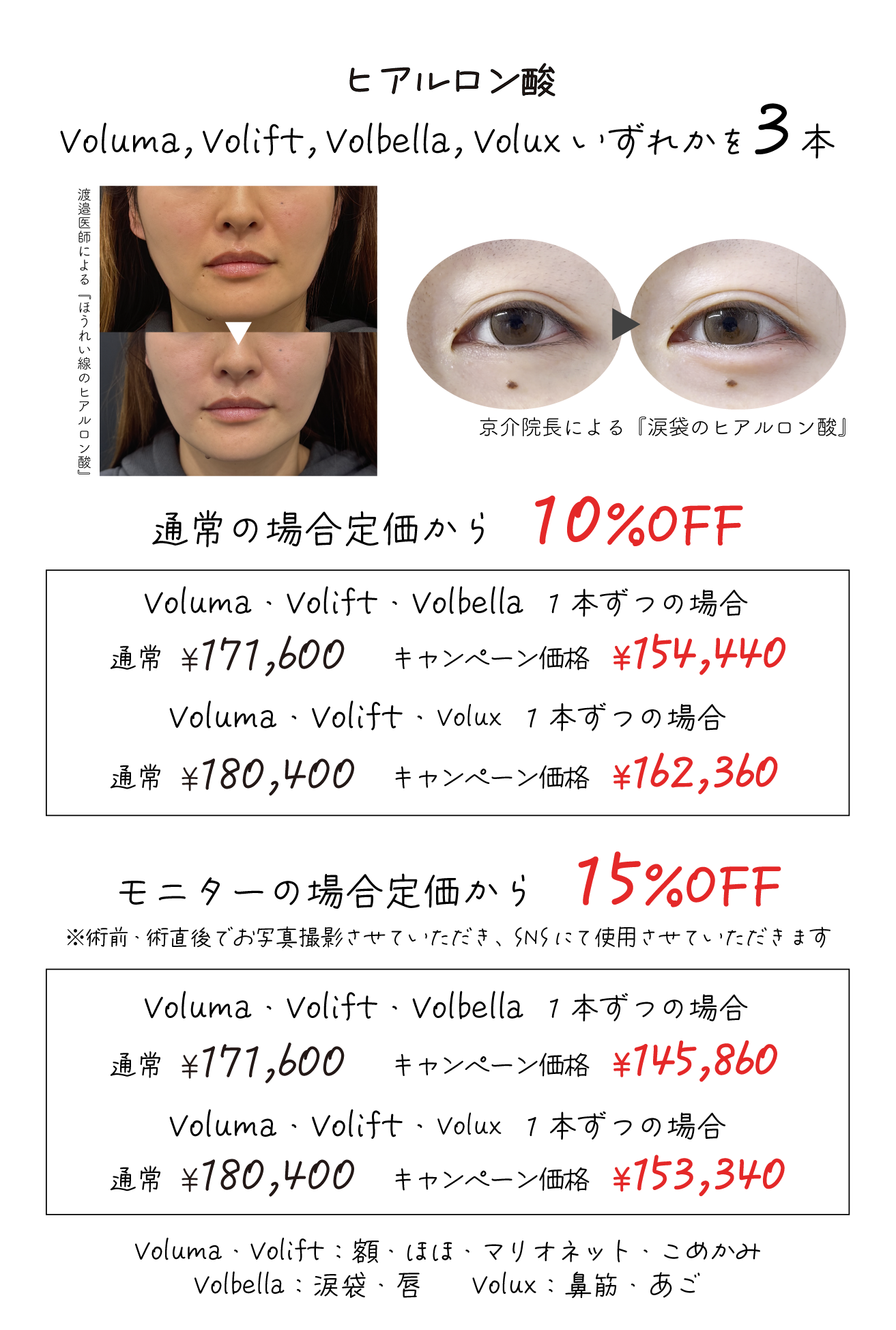 モニターも募集！