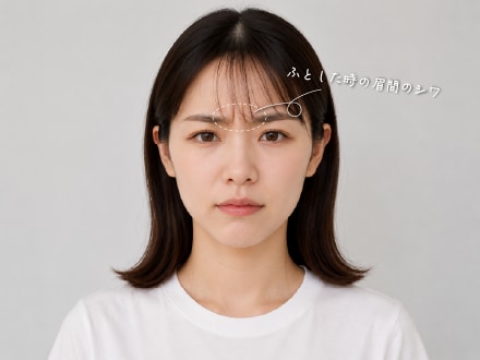 眉間のボトックス