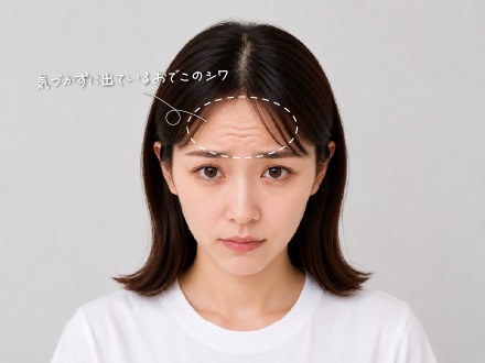 額のボトックス
