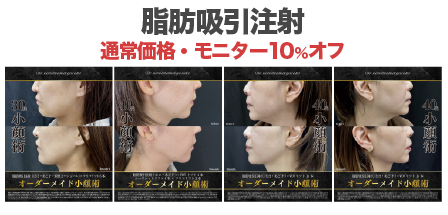 宇都宮で出来る脂肪吸引