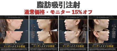 宇都宮で出来る脂肪吸引