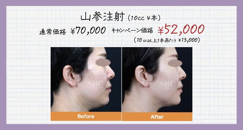 山参注射