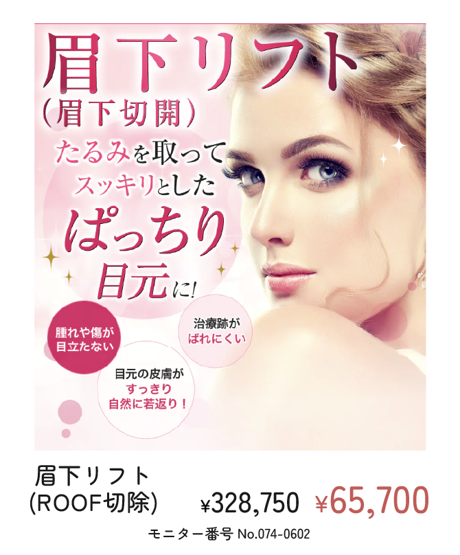 眉下リフト