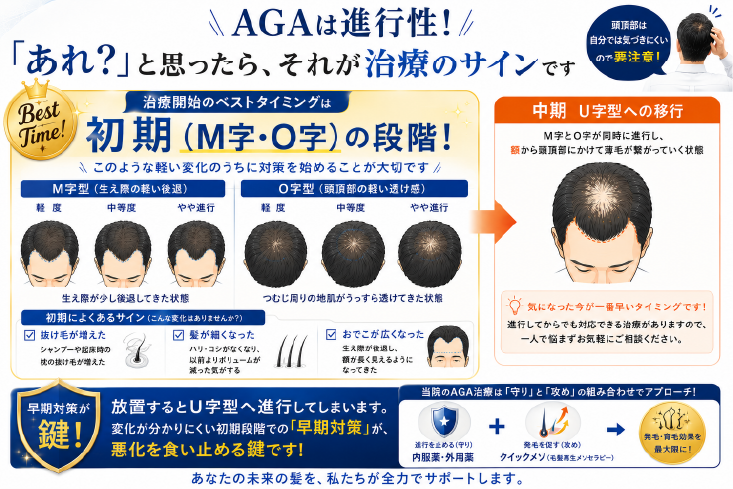 進行性のAGAは「早期治療」が重要！
