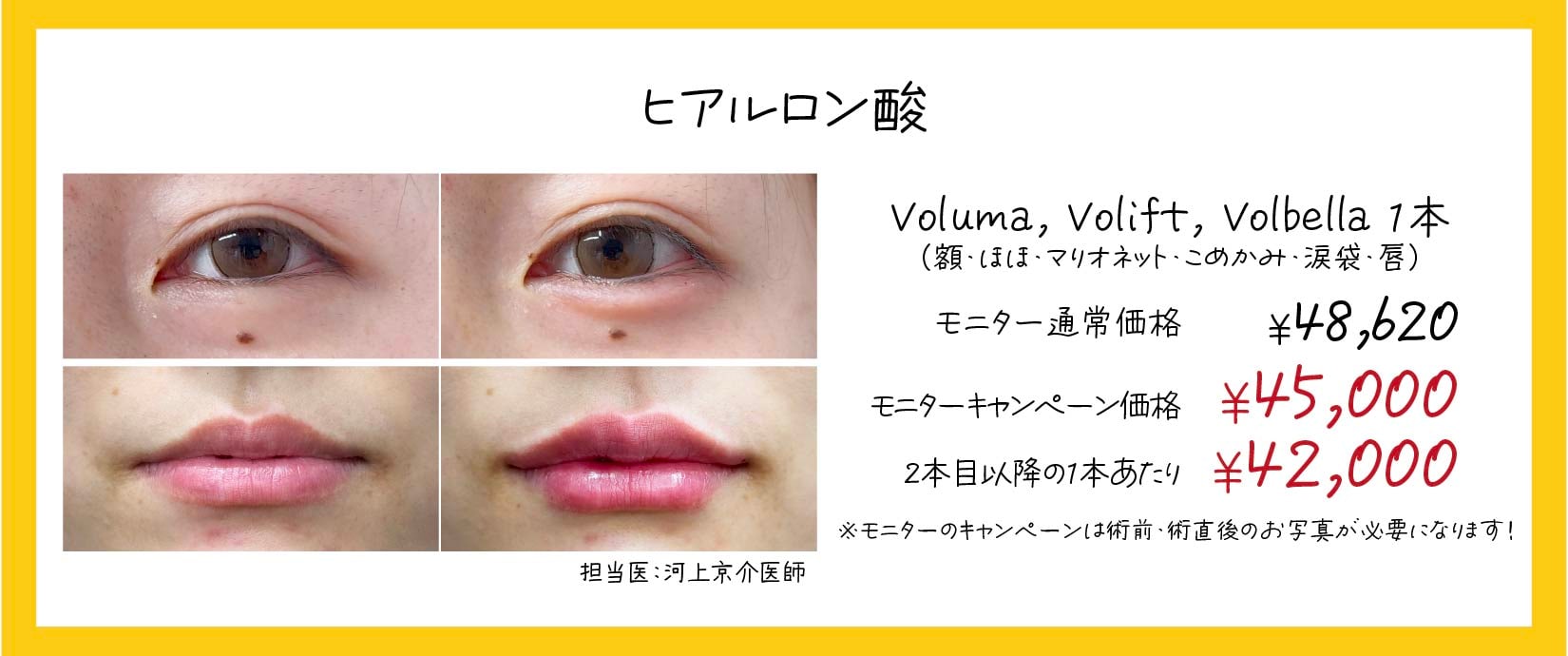 涙袋や唇に