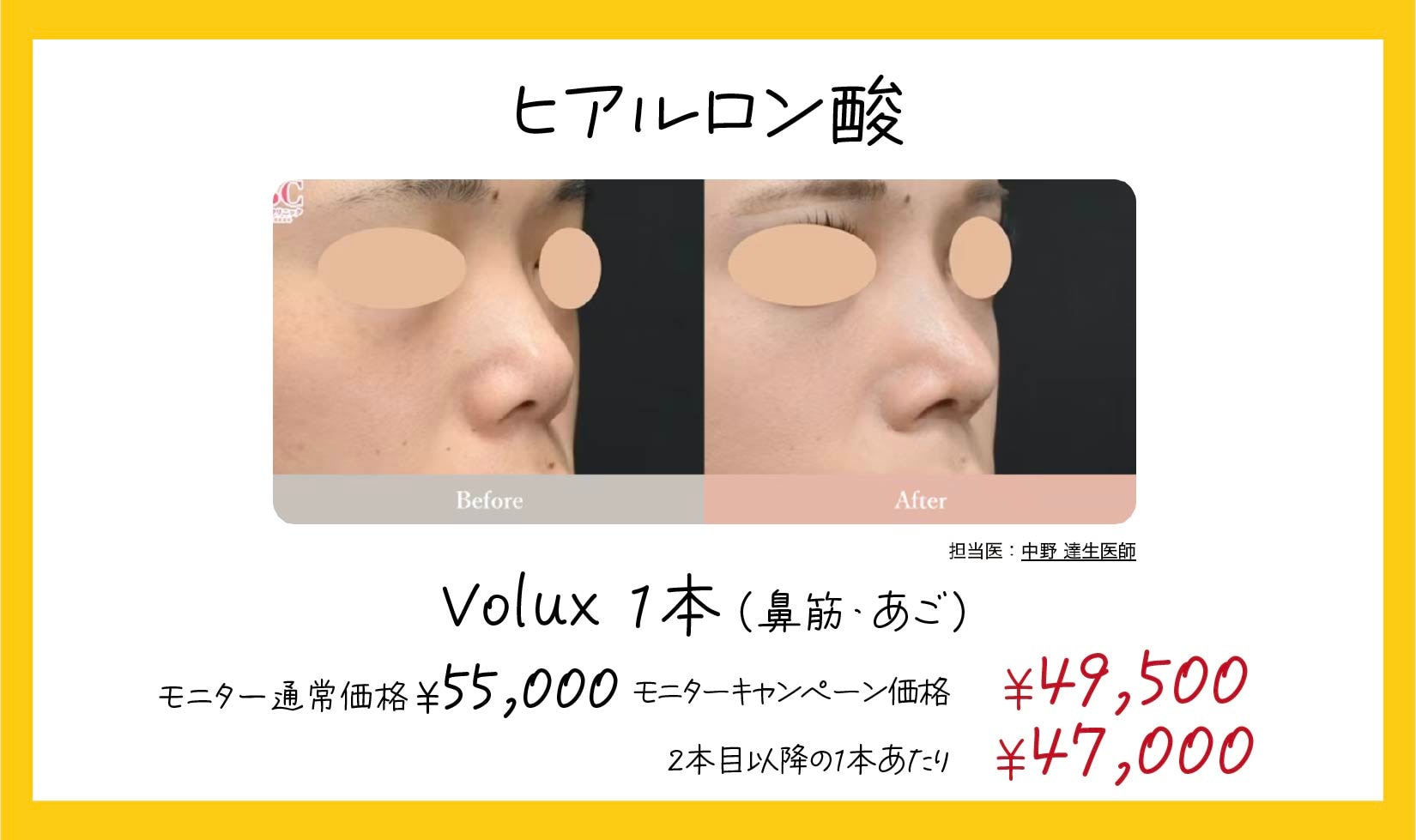 鼻筋やあごに