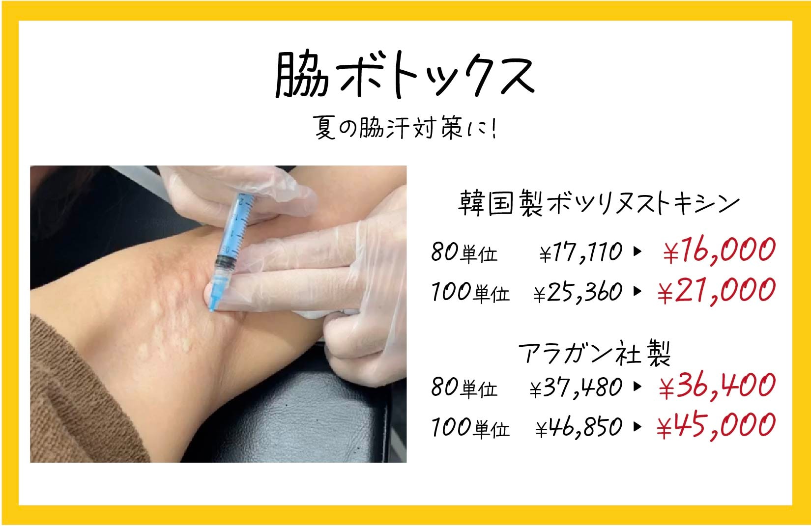 ボトックスで汗の分泌を止める！