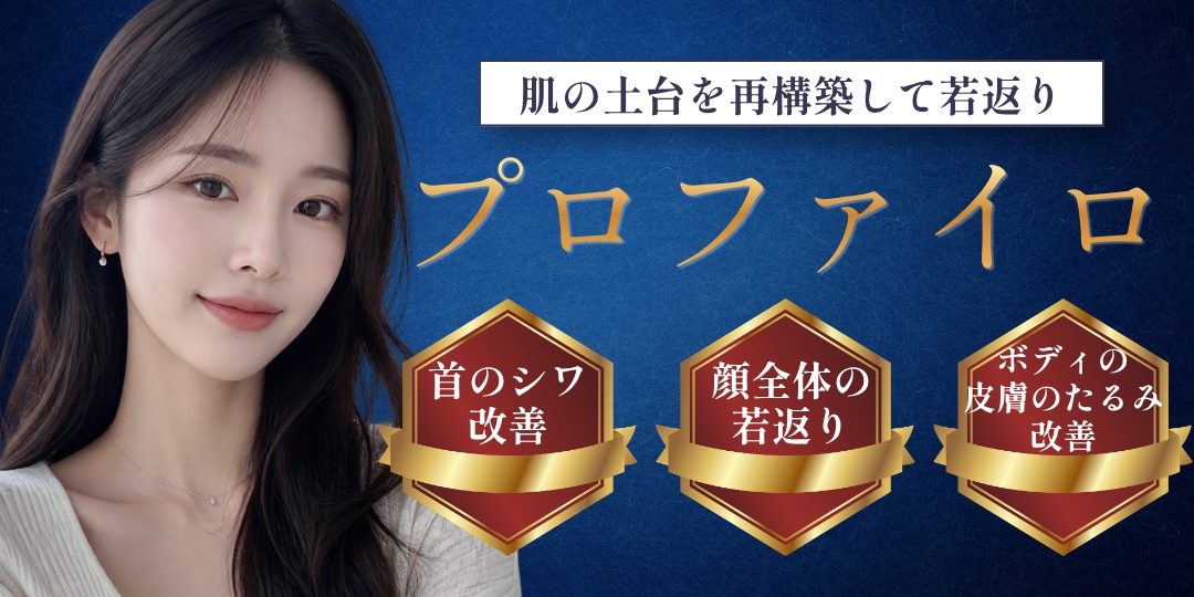 プロファイロ