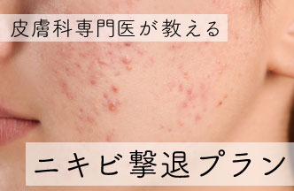 ☆皮膚科専門医が教える☆　ニキビ撃退プラン