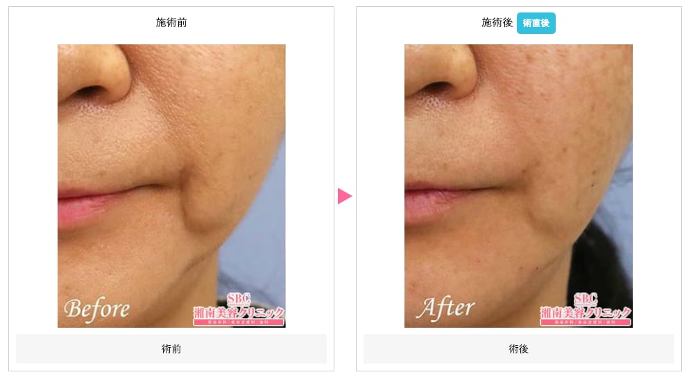 マリオネットライン