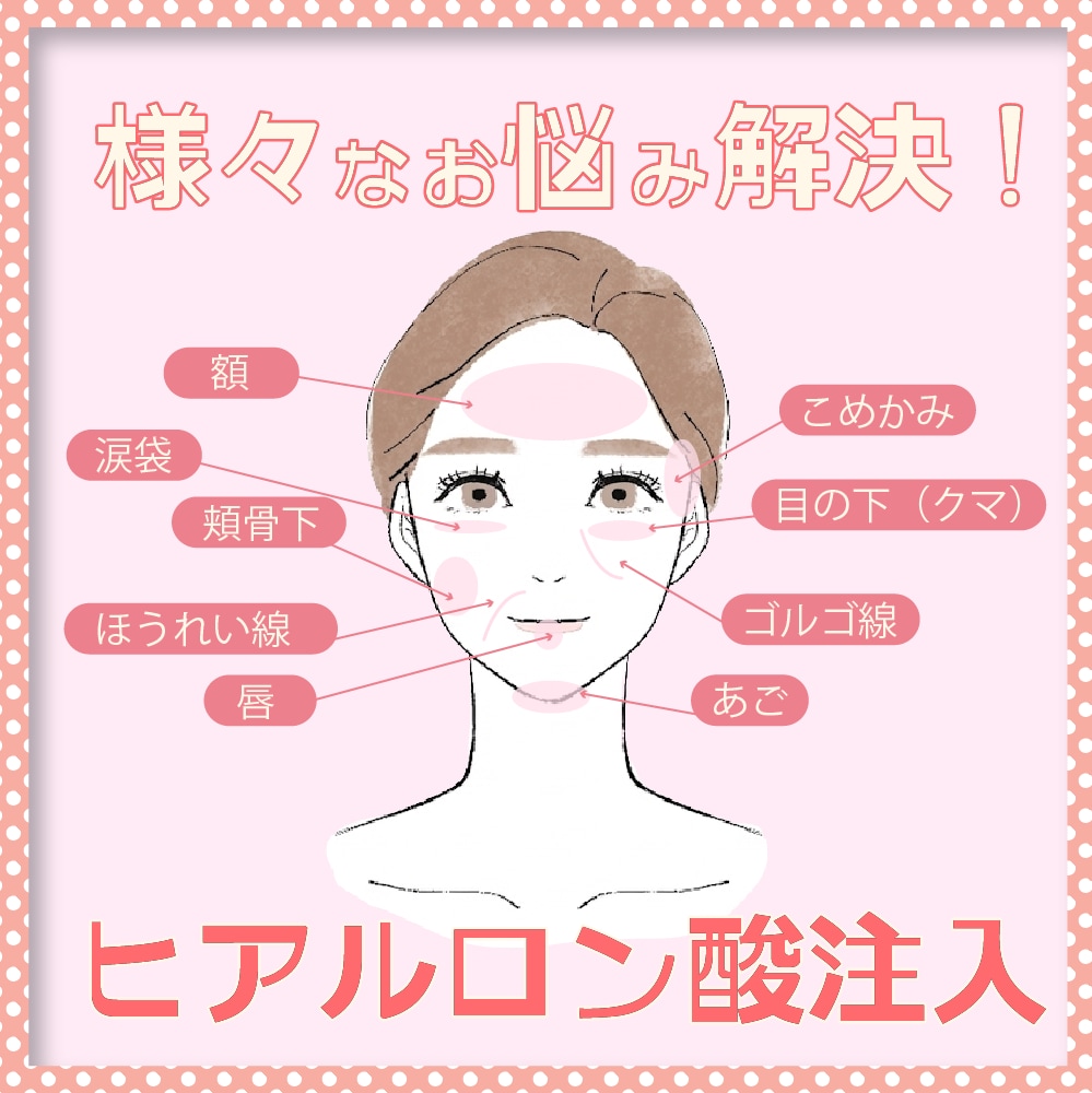 ヒアルロン酸の魅力を解説♡