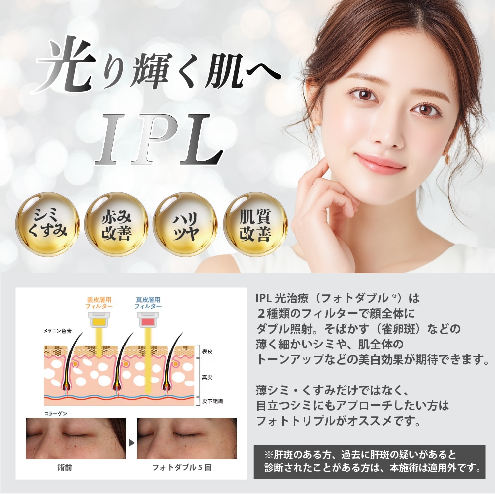 シミ・色ムラ・くすみが気になる方