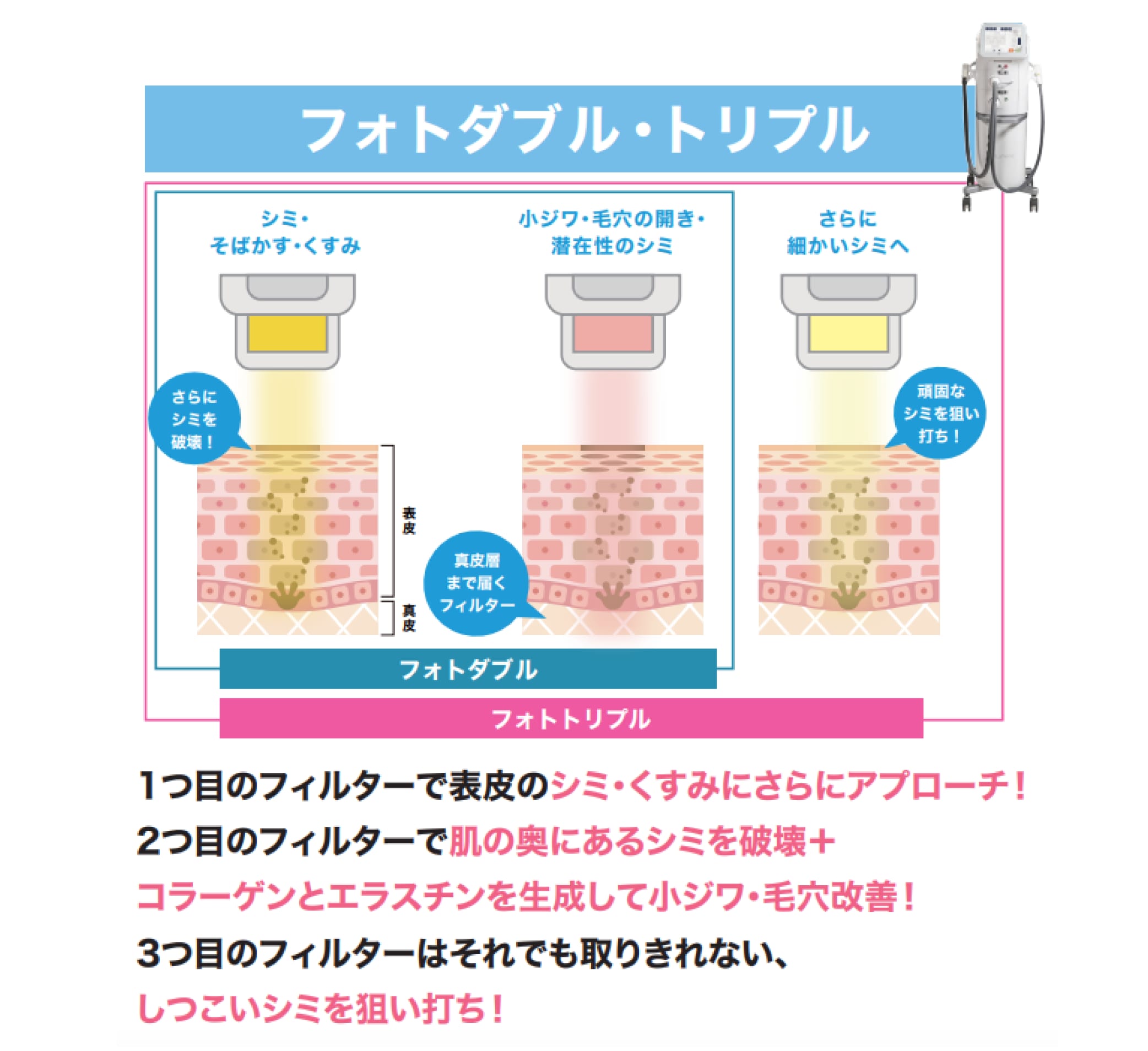 ステラM22はフィルターを使い分けて“3段階アプローチ”✨
