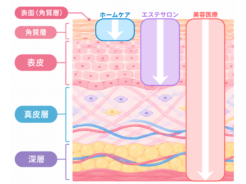 なにが違うの？