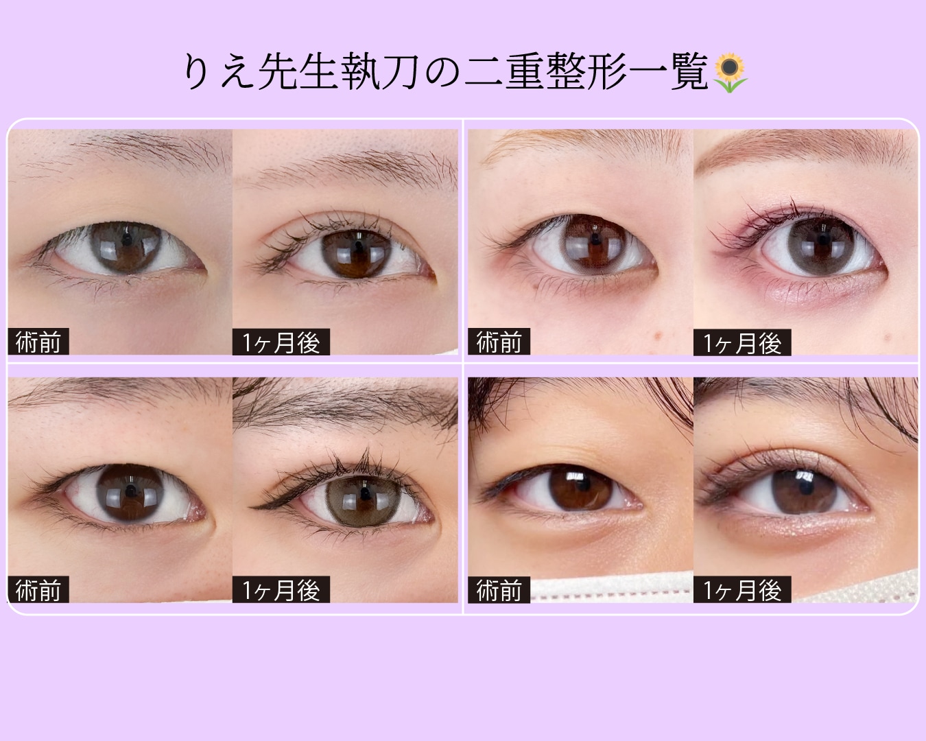 りえ先生の症例