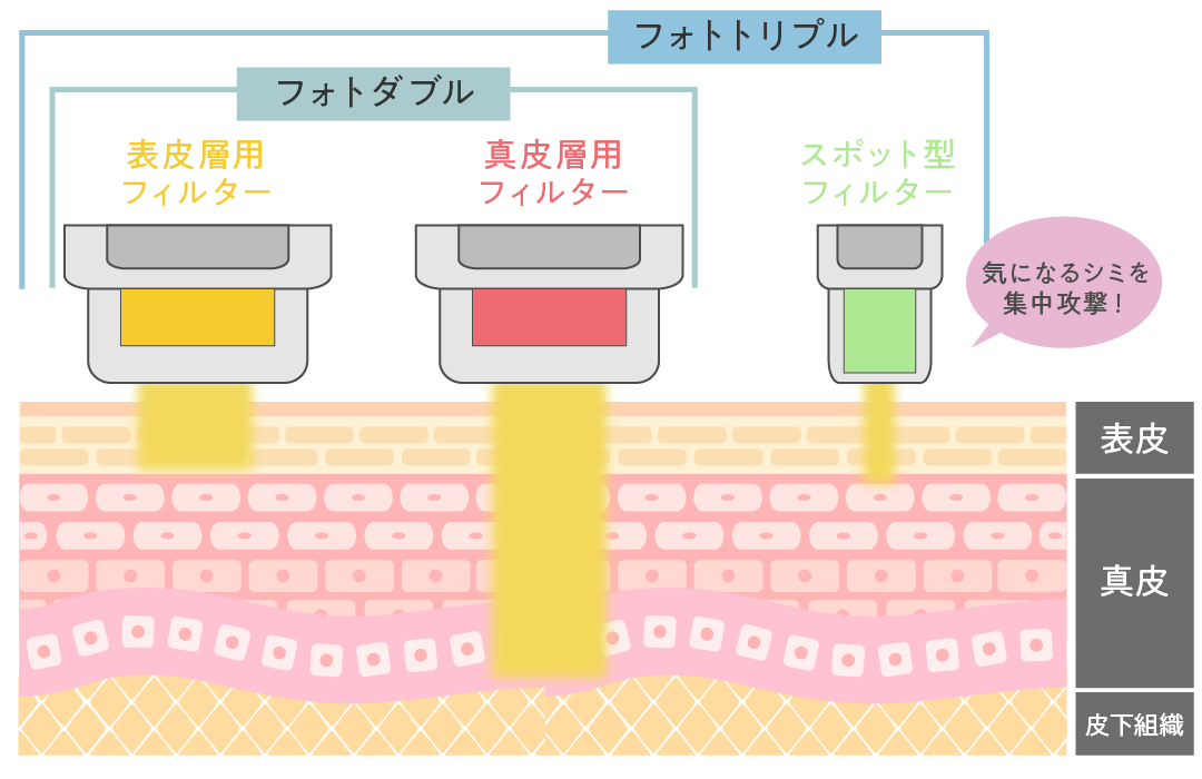 フォトダブル/トリプル