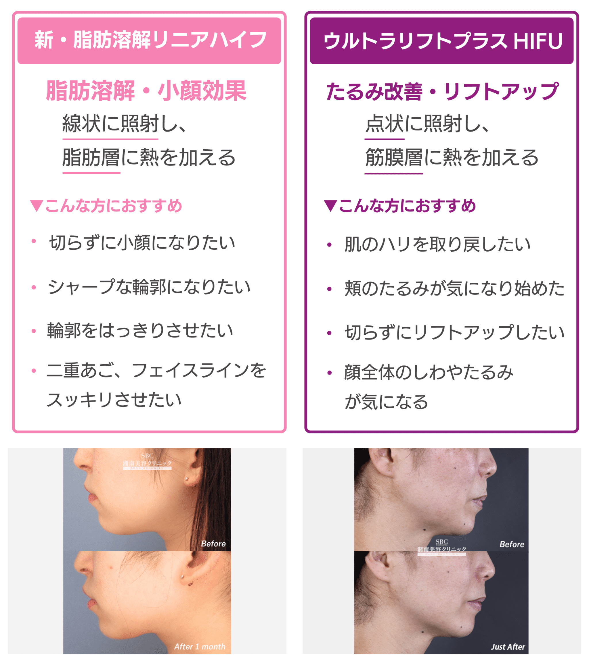 2つを比較
