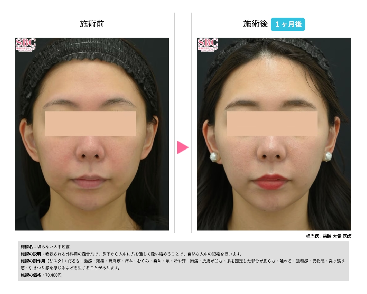 切らない人中短縮