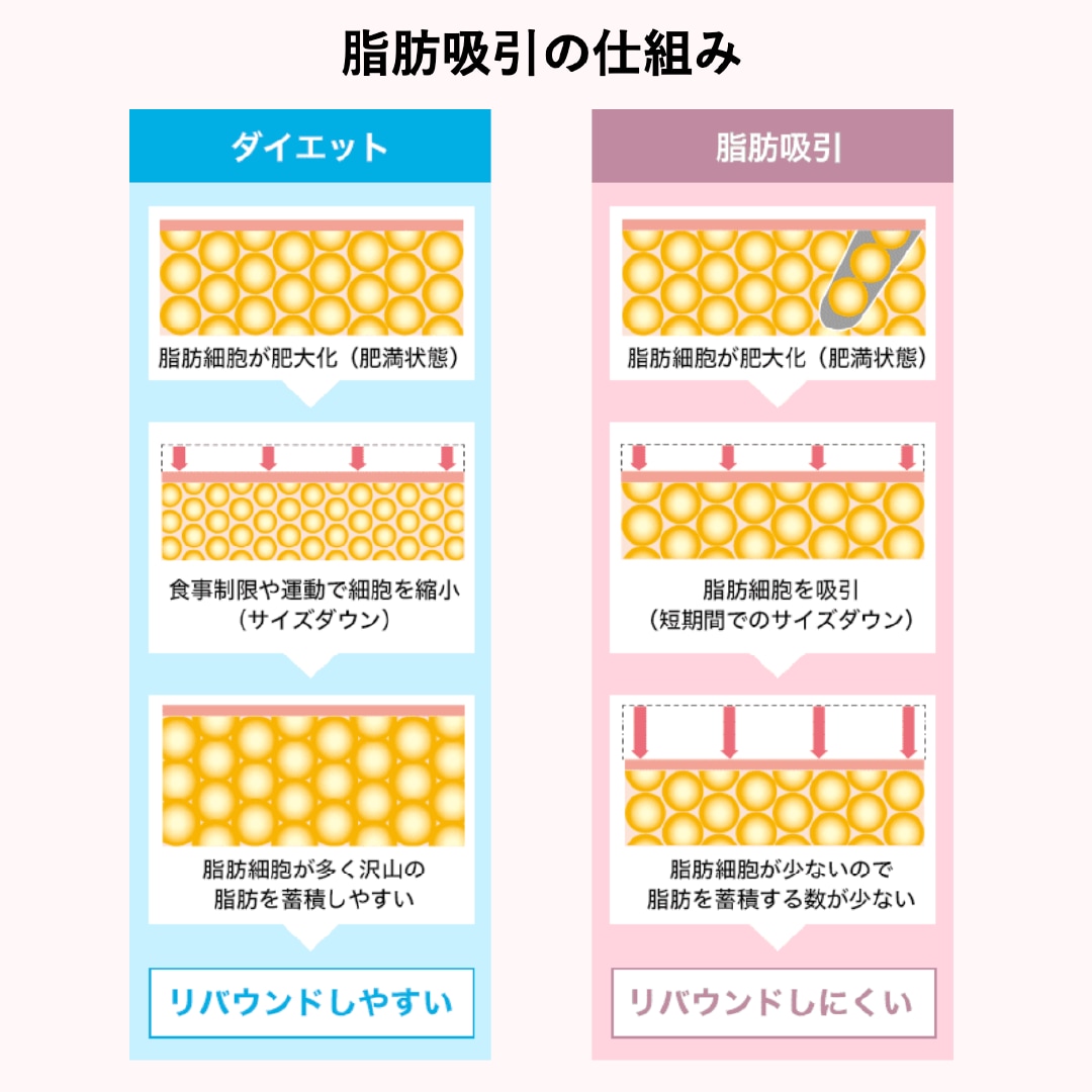 厄介な脂肪とはもうサヨナラ