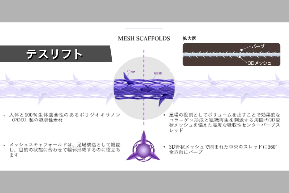 網目状の3Dメッシュで覆ったテスリフト