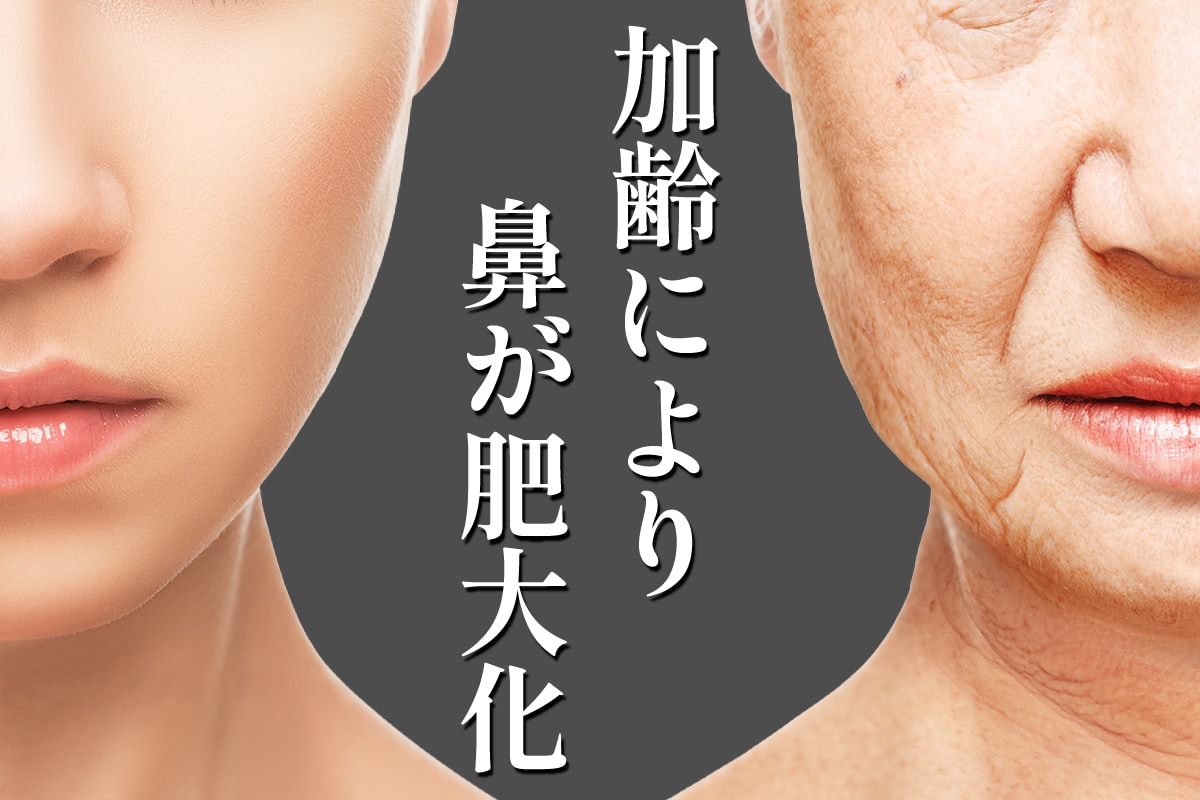 骨格の縮小・変形