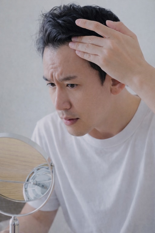 AGAとは【男性型脱毛症】のこと