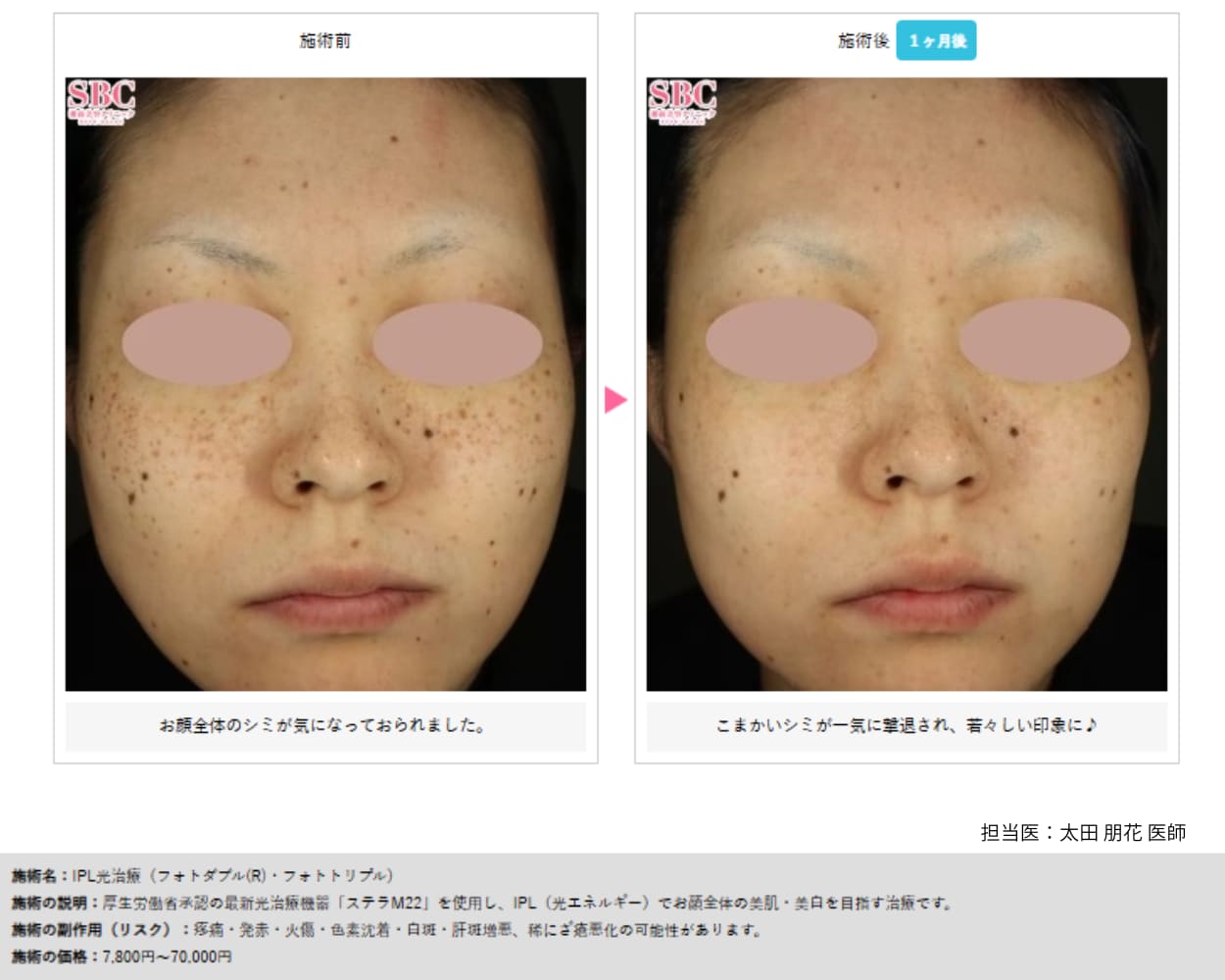 フォトトリプル