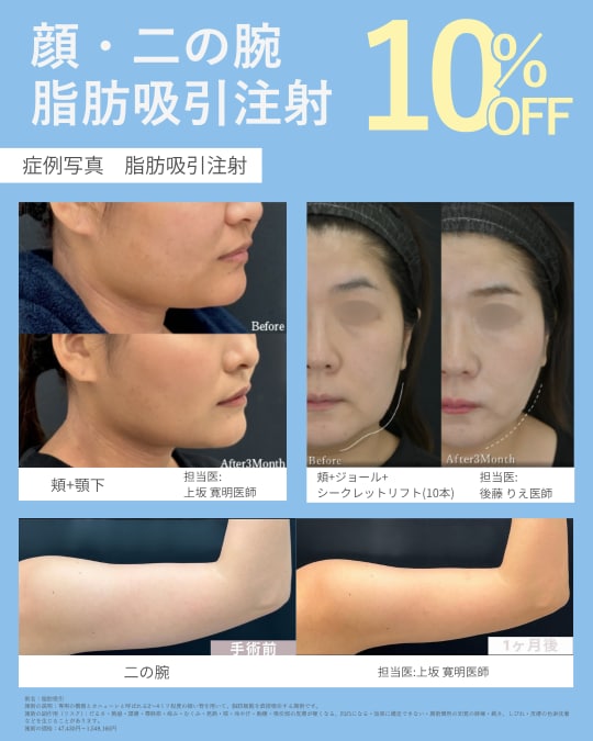脂肪吸引