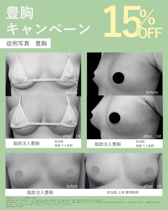 豊胸