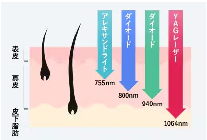根深いヒゲ根・根強い毛の奥まで届く波長