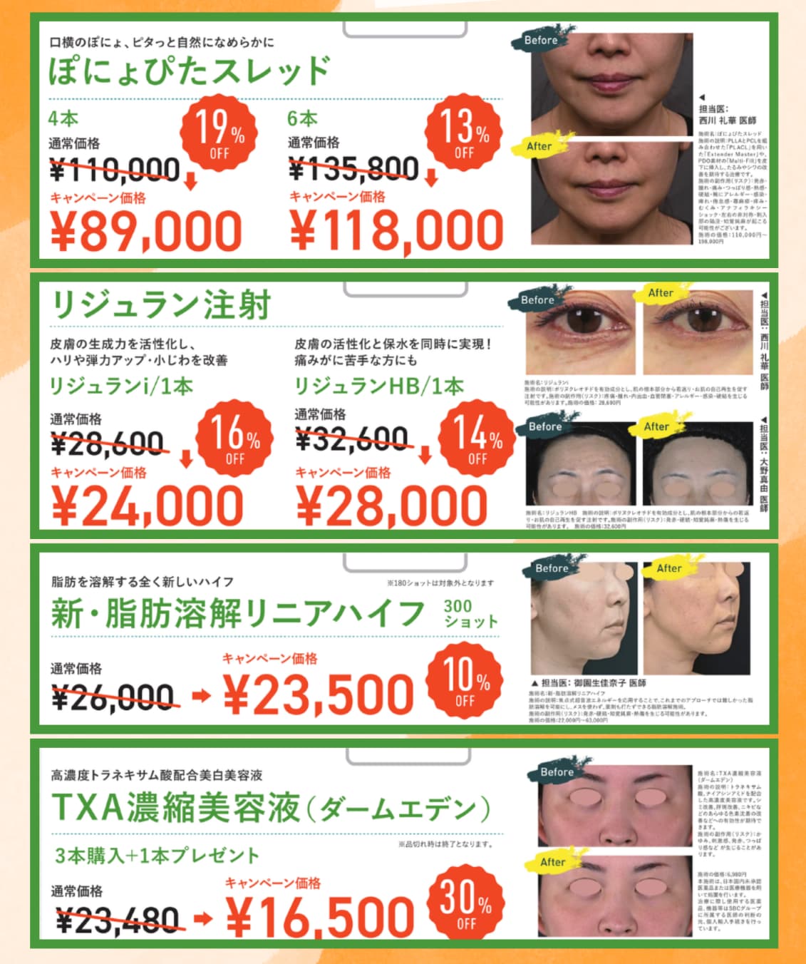 9月キャンペーン