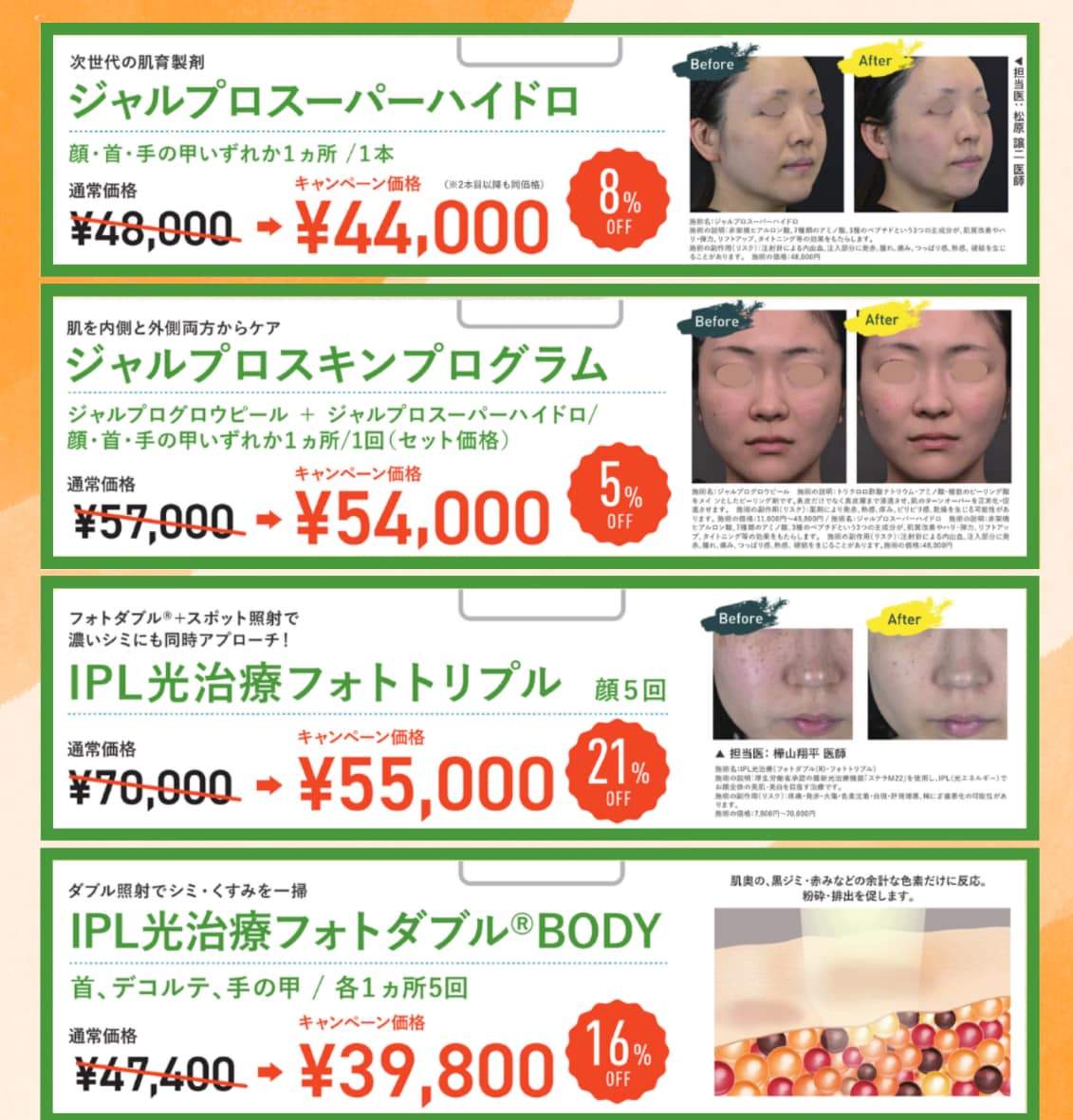 ９月キャンペーン
