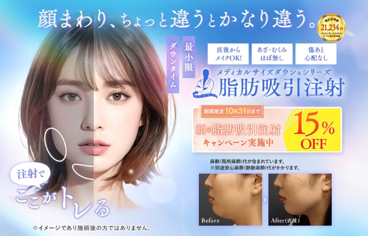 脂肪吸引注射
