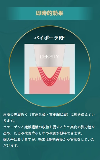 浅い層にアプローチする「バイポーラRF」