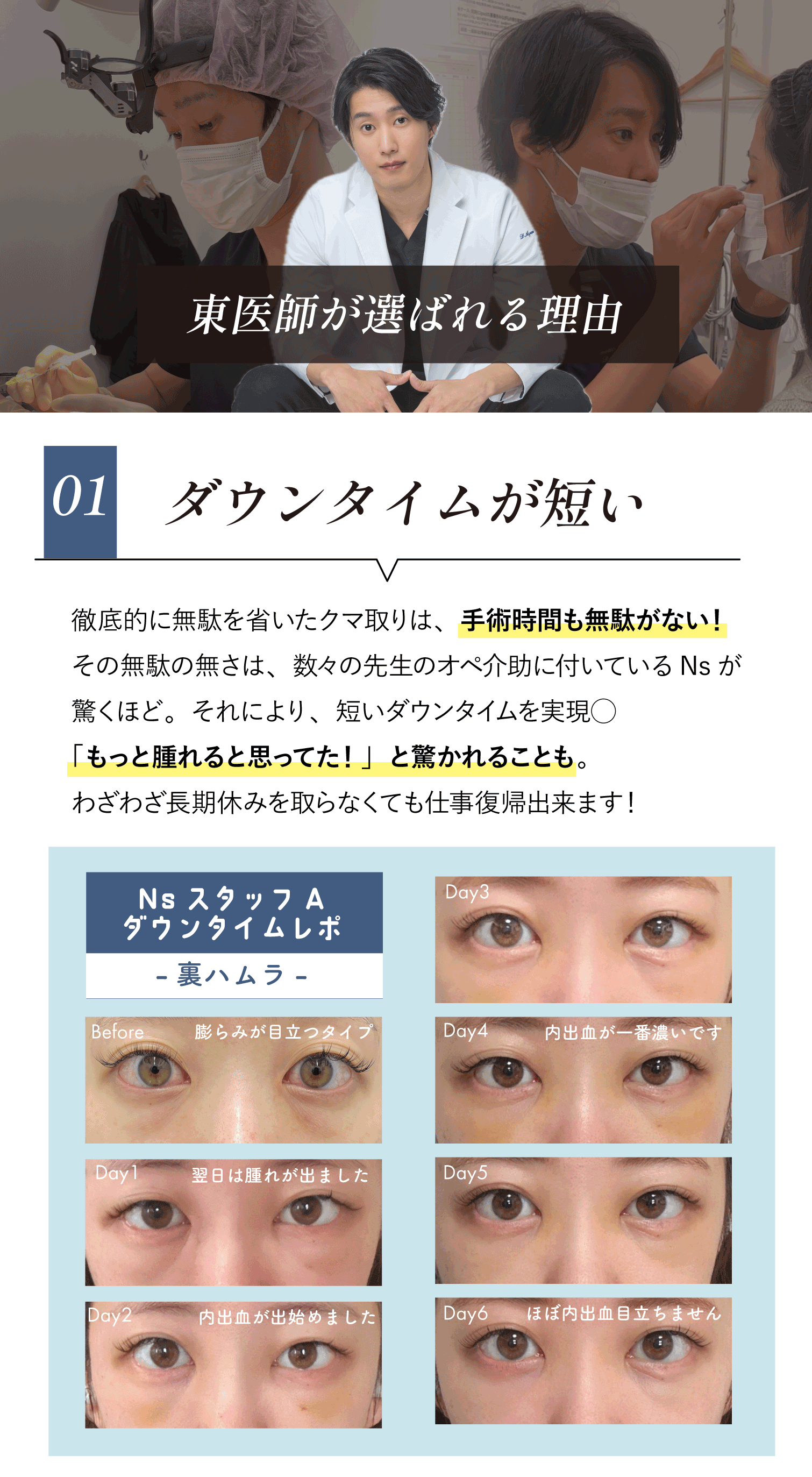①ダウンタイムが短い🕰️
