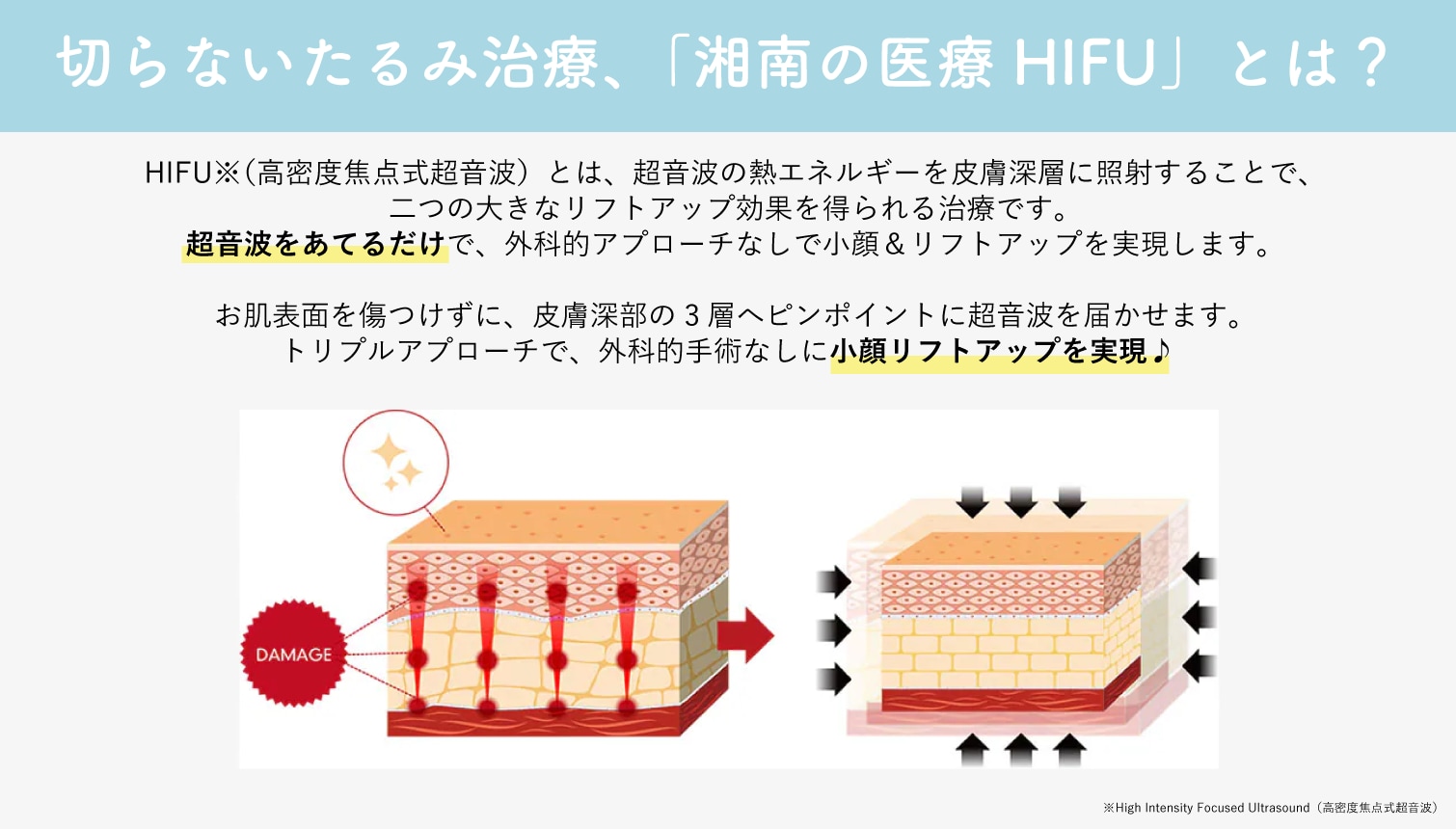 湘南の医療HIFU