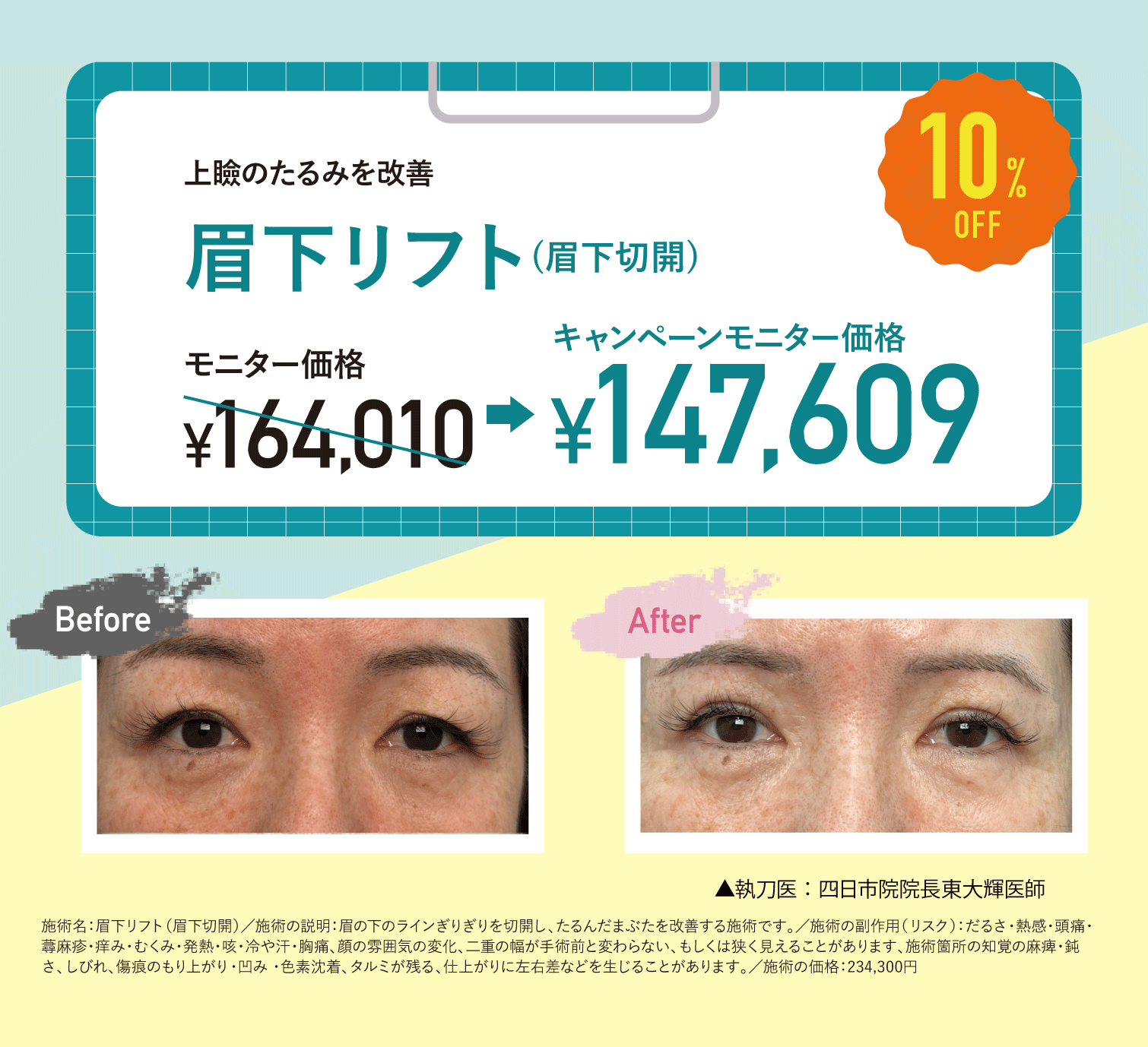 たるみ治療専門医の眉下切開!