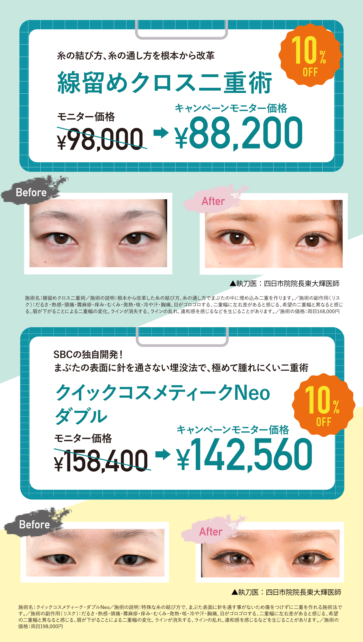 クイックコスメティークダブル&線留めクロス二重術