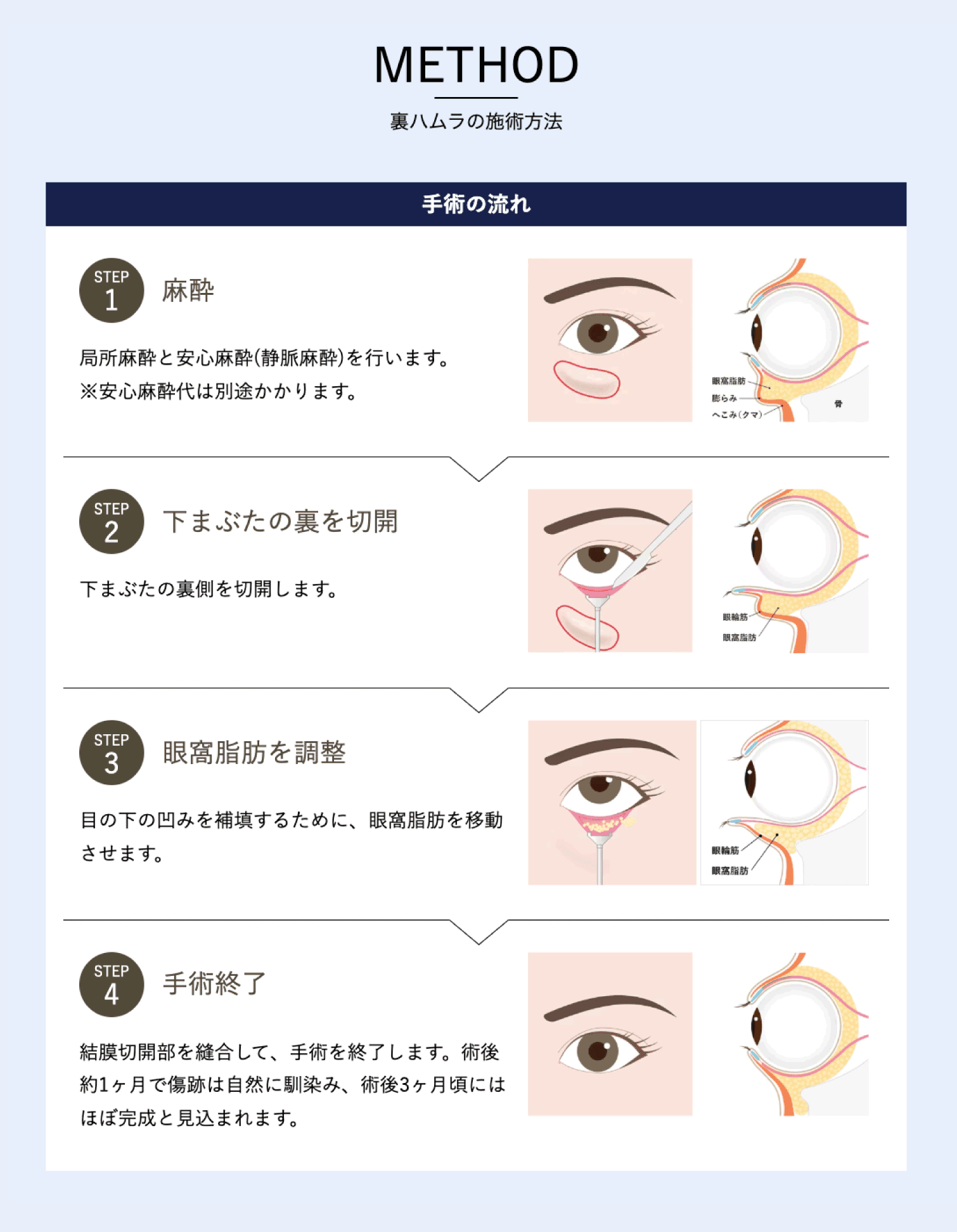 施術の流れ