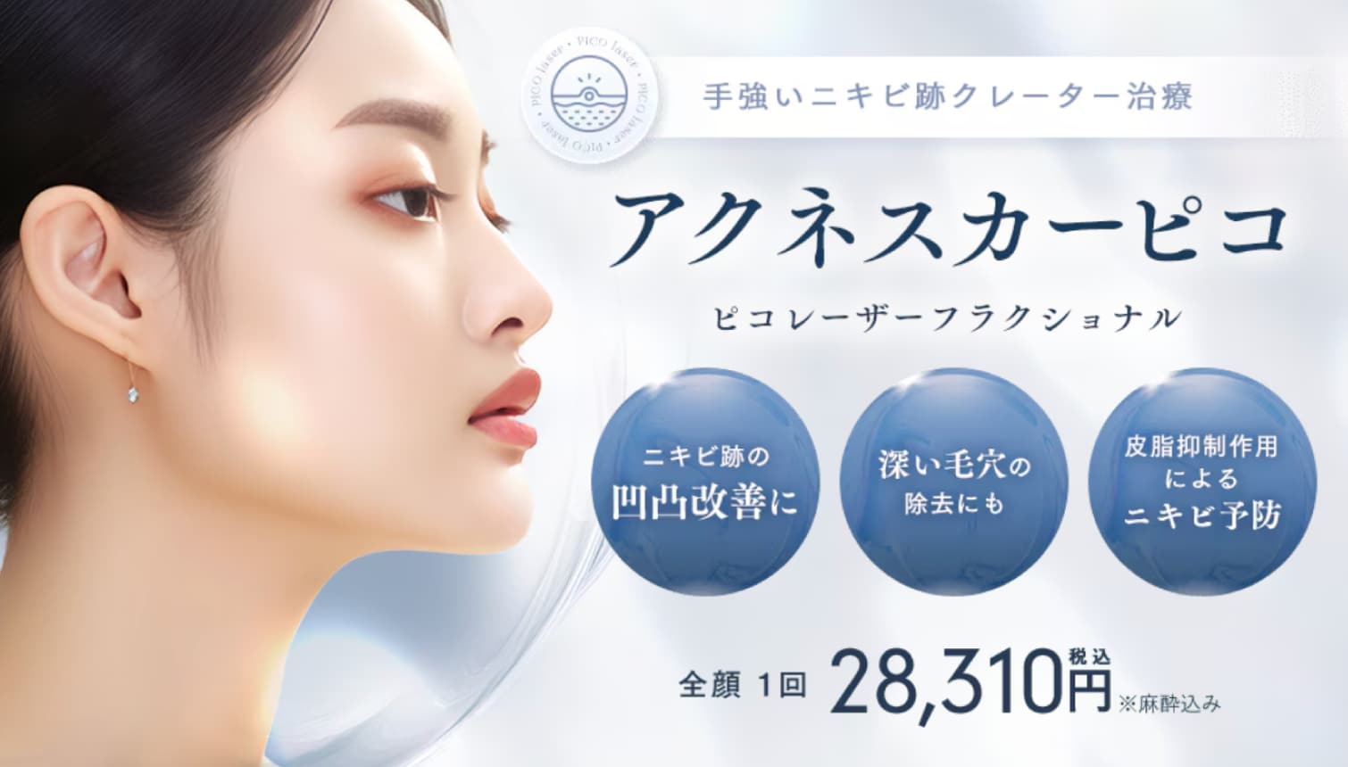 アクネスカーピコ