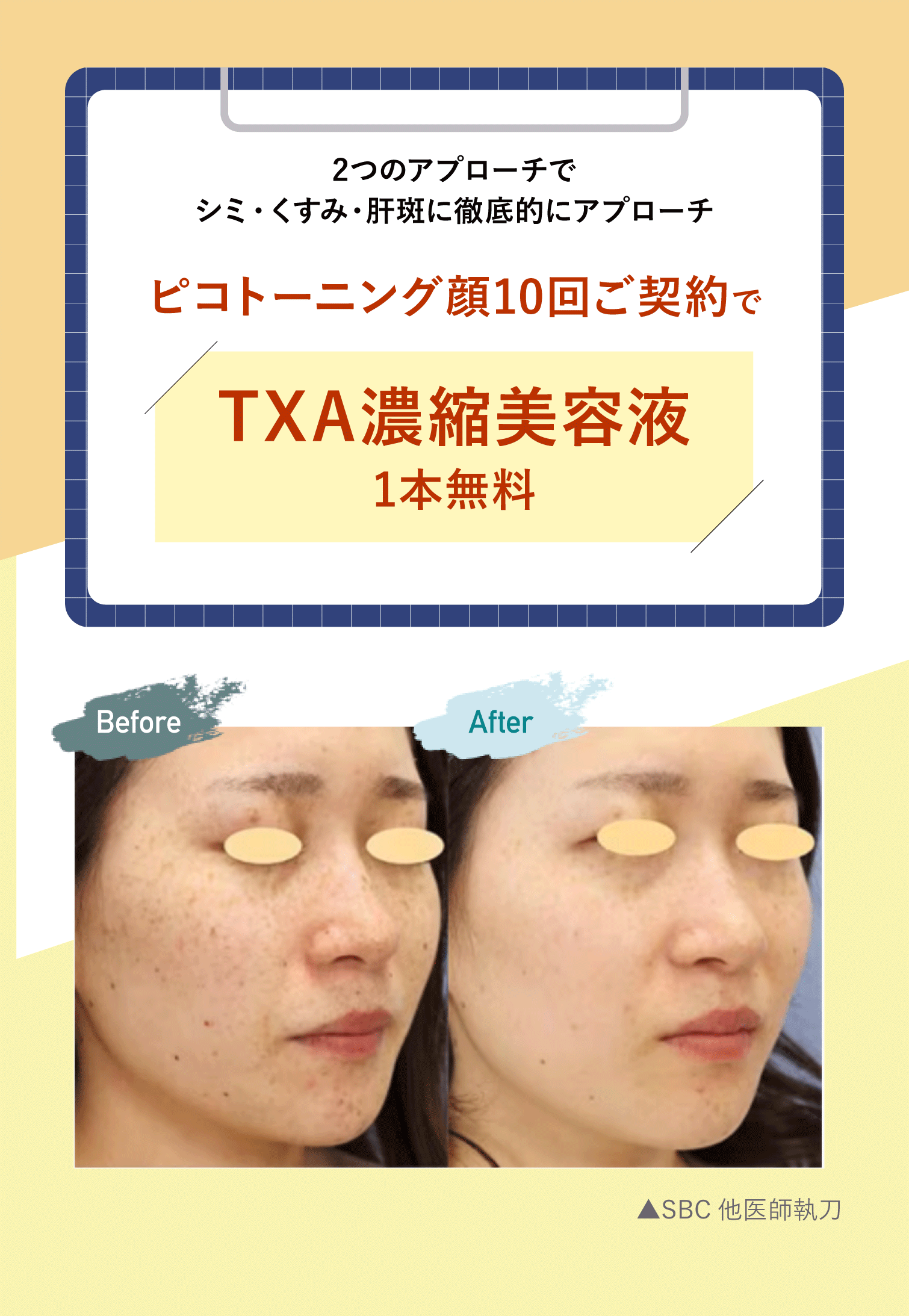 ピコトーニングコースご契約で【TXA濃縮美容液】がプレゼント🎁